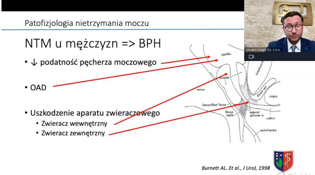 17-nietrzymanie-moczu-2